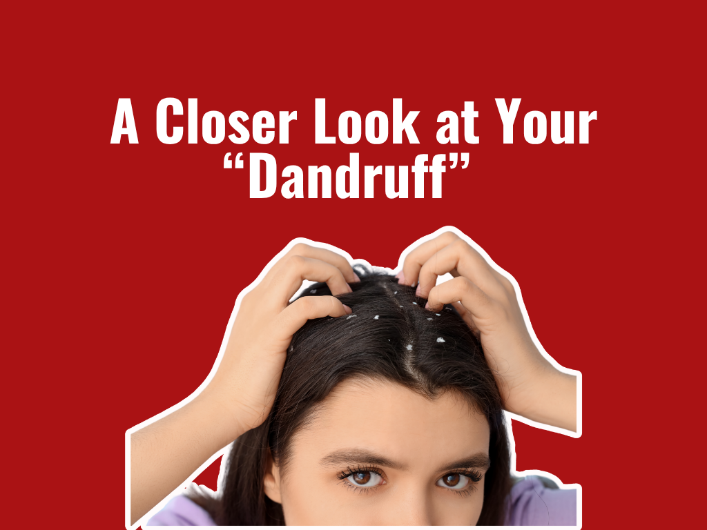Dandruff vs Sensitive Scalp