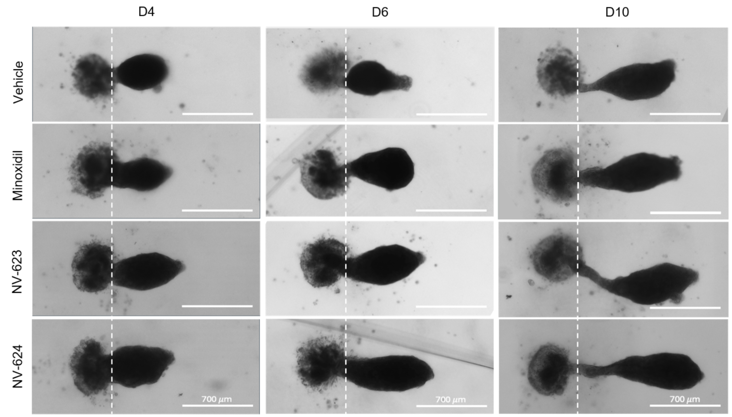 NOVOGRO™ vs Minoxidil organoid sprouting comparison
