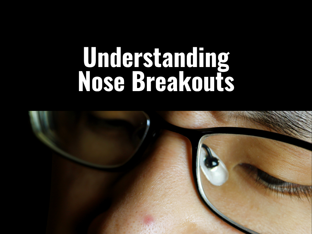 Nose Breakout