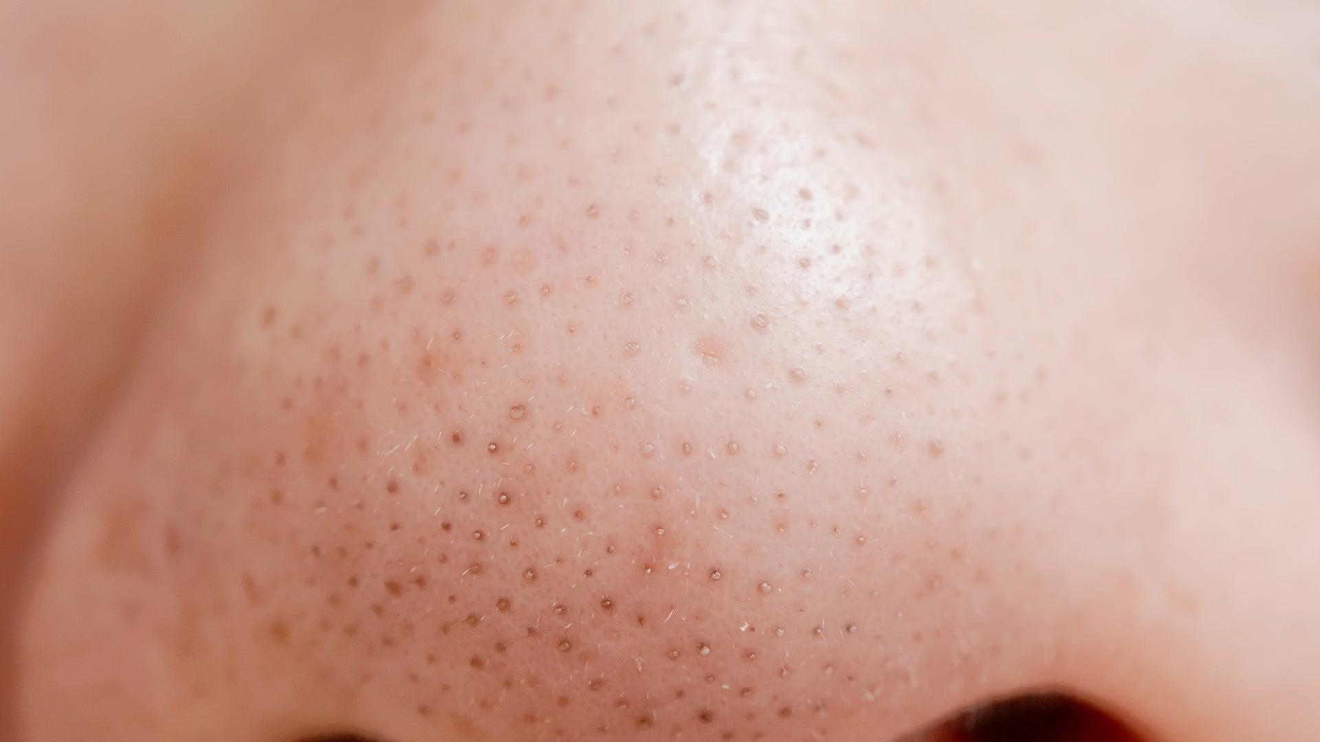 Extreme close-up of the skin on a nose showing visible pores and sebaceous filaments